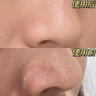 SUMDOY進(jìn)口去黑頭粉刺收縮毛孔黑頭導出液50ml*3男女深層清潔鼻膜貼套裝 曬單實(shí)拍圖