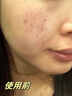 儒意（RUYI）紫蘇壬二酸清潔泥膜150g面膜深層去黑頭收縮毛孔祛痘金榜第1名 曬單實(shí)拍圖