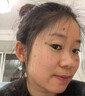 妍膚美白祛斑霜祛斑老年黃褐斑雀斑曬斑男女士專用的去斑去黑色素正品 醫(yī)用液【祛斑液】1盒 20g 【無效秒退】 377+577臉部手背專用霜去老人斑 曬單實(shí)拍圖