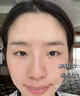 OHBT祛痘膏60g青春痘閉孔粉刺收縮毛孔專用學(xué)生男女凝膠男士化妝品 曬單實(shí)拍圖