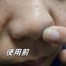 儒意黑頭導出液去黑頭收縮毛孔粉刺深層清潔黑頭清理神器美容院專用 【控油清毛孔】去黑頭水 150ml 曬單實拍圖