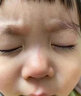御夫清美國進口疤克巴克祛疤膏兒童去疤痕修復凝膠小孩專用除去疤膏手術 曬單實拍圖