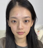 BAJK水光針原液自美白提亮去黃改善暗沉膚色抗氧化抗皺緊致精華液油打 【日本進(jìn)口】美白水光針原液3支 水光針原液自美白提亮去黃打 曬單實(shí)拍圖