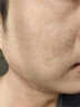 內(nèi)廷上用痘印痘坑修復(fù)凹洞去痘坑填充再生修復(fù)痘疤男凹坑淡化消除黑色素 痘印痘坑修復(fù)凹洞填充再生 一盒裝 曬單實拍圖