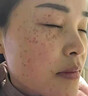 片仔癀美白淡斑套裝組合淡化黑色素老年黃褐雀斑曬斑煙酰胺祛斑霜護(hù)膚品 祛斑四件套【水+乳+精華+霜】 曬單實(shí)拍圖