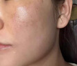 意匠優(yōu)禮美容儀面罩大排燈面膜儀家用臉部紅藍(lán)光子嫩膚儀抑黑促生膠原祛痘修護(hù)面膜儀 送女友七夕節(jié)禮物 光子美容面罩 曬單實(shí)拍圖