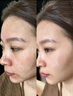 OHBT黃芪面膜10片抗皺緊致抗衰老補(bǔ)水熬夜美白淡斑女男士金榜第1名 曬單實(shí)拍圖