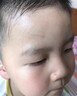 奕祛芭祛疤痕專用修復(fù)去疤痕修復(fù)凝膠除疤膏痕增生凸起去除疙瘩祛疤膏*3 曬單實(shí)拍圖