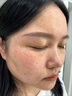 壬二酸煥顏精華凝膠凝露改善暗沉補(bǔ)水保濕滋潤霜官方旗艦店正品 1盒醫(yī)師推薦壬二酸嫩白精華 曬單實(shí)拍圖