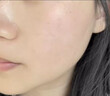 白云山藍(lán)銅肽凍干粉美白修復(fù)醫(yī)用保濕補(bǔ)水淡斑祛痘印痘坑修復(fù)收縮毛孔祛 一盒體驗裝 曬單實拍圖