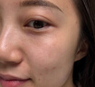 儒意（RUYI）淡紋眼霜30g淡化細紋眼紋抗皺提拉緊致黑眼圈祛護膚品眼袋衰老 曬單實拍圖