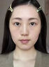 眉毛增長(cháng)液醫用級進(jìn)口濃眉毛生增長(cháng)液男女士通用野生眉睫毛營(yíng)養液 植萃精華：【買(mǎi)2送1】到手3瓶 曬單實(shí)拍圖