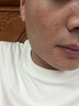 百靈鳥377美白祛斑霜祛斑美白淡化黑色素去雀斑老年黃褐斑男女士專用 曬單實拍圖
