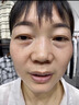 片仔癀美白淡斑套裝淡化黑色素老年黃褐雀斑曬斑提亮煙酰胺祛斑霜護膚品 祛斑四件套【水+乳+精華+霜】 曬單實拍圖