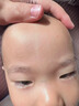 邦孚手美國進(jìn)口硅酮去祛疤痕修復(fù)凝膠醫(yī)用醫(yī)院專用去疤膏兒童手術(shù)縫針 曬單實(shí)拍圖