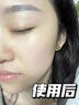 韓方五谷377美白補水保濕精華液次拋祛斑提亮去黃護膚品抗氧煙酰胺男女士 曬單實拍圖