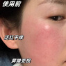 ORGINESE積雪草爽膚水清爽控油補(bǔ)水保濕敷玻尿酸精華水化妝水500ml護(hù)膚品 曬單實(shí)拍圖
