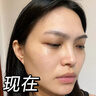 透真377美白精華液次拋淡化黑色素祛斑去黃提亮改善暗沉膚色煙酰胺女 曬單實(shí)拍圖