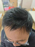 TOPPIK美國進口增發(fā)頭發(fā)纖維粉發(fā)縫補發(fā)發(fā)際線噴霧頂豐密發(fā)神器男女通用 黑色27.5克＋送優(yōu)化梳 曬單實拍圖