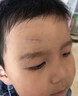 奕祛芭祛疤痕專用修復(fù)去疤痕修復(fù)凝膠除疤膏痕增生凸起去除疙瘩祛疤膏*3 曬單實(shí)拍圖