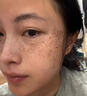 萊覽奧蓋祛斑霜美白淡化老年黃褐雀斑黑色素專用去除男女士一夜消醫(yī)用正品 純中藥美白祛斑霜 臉部手背祛斑效果最好的產(chǎn)品 曬單實(shí)拍圖