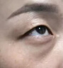 脂肪粒去除藥膏眼部專用神器去眼周小顆粒油脂粒眼霜消汗管瘤克星 一盒裝：專用精華素 曬單實拍圖