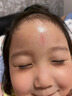 邦孚手美國進口硅酮去祛疤痕修復凝膠醫(yī)用醫(yī)院專用去疤膏兒童手術縫針 曬單實拍圖