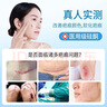 北京同仁堂醫(yī)用硅酮祛疤痕修復(fù)凝膠剖腹產(chǎn)傷疤痕增生凸起疙瘩專用去除疤痕膏 大人兒童刀傷摔傷燙傷疤醫(yī)用硅酮疤痕凝膠20g*5支 醫(yī)院同款 曬單實(shí)拍圖