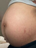ZOCC硅酮凝膠zkk小藍管修紋祛紋淡化肥胖紋妊娠紋生長紋法令紋頸紋 zkk修紋膏 1支【體驗裝】 曬單實拍圖