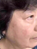 巖井昃弘老年斑專用膏藥貼一夜消手部臉部手背祛斑霜去老人斑除的強力黃褐 一盒（100%發(fā)貨特效快） 曬單實拍圖