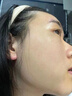 維特絲壬二酸祛痘藥膏去痘痘粉刺閉口收縮毛孔男女煙酰胺水楊酸 曬單實拍圖