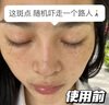 焦博士日本377祛斑霜美白淡化老年黃褐雀斑黑色素熊果苷乳膏去曬男女士 曬單實拍圖