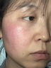 Newliann醫(yī)用重組膠原蛋白修復(fù)敷料乳液人表皮生長(zhǎng)因子凝膠皮膚屏障面霜 曬單實(shí)拍圖