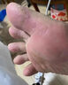 香港大藥房真菌王抑菌止癢膏真菌腳氣感染腳臭腳后跟開裂干裂脫皮膚膏官方 1盒【見效裝】 曬單實拍圖