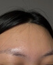 維特絲壬二酸祛痘藥膏去痘痘粉刺閉口收毛孔男女煙酰胺水楊酸青少年凝膠 曬單實(shí)拍圖