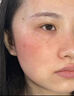 Andwarm原裝進(jìn)口曬后修復(fù)凝膠女男士?jī)和娌考∧w膏臉曬傷修復(fù)補(bǔ)水蘆薈膠 100ml【緊急舒緩修護(hù)】 曬單實(shí)拍圖