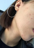 妙古方優(yōu)侯清噴霧噴劑抑菌液疣瘊小肉粒草本萃取直播款優(yōu)候清官方旗艦店正品 一盒裝【不參與買送】 曬單實(shí)拍圖