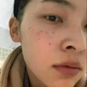 白云山377煙酰胺面霜美白祛斑霜淡化黑色素去老黃斑雀斑補水保濕30g 曬單實拍圖