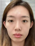 儒意（RUYI）377美白面膜補水男士保濕淡斑提亮膚色女抗皺緊致抗衰老去黃第1名 曬單實拍圖