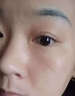 汗管瘤眼部去除油脂粒祛眼部周圍脂肪粒專用眼霜眼油脂粒涂抹藥膏 單盒裝 曬單實(shí)拍圖