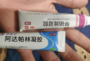麗芙阿達(dá)帕林凝膠16g+甲硝唑銼凝膠20g去黑頭修復(fù)毛孔收縮毛孔粗大祛痘印修復(fù)淡化痘印痘坑修復(fù)藥膏 曬單實(shí)拍圖