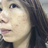 白樺依然祛痘膏美白去痘痘和痘印修復(fù)初高中生男女學(xué)生閉口粉刺青春痘30g 3瓶療程裝 【立省40】 曬單實拍圖