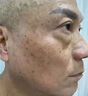維A酸乳膏祛斑男士專用藥臉部內(nèi)調(diào)祛斑中藥臉部配排毒養(yǎng)顏i片去斑去黑色素淡化黃褐斑老年斑專用藥一夜非消 1盒裝【去斑專用醫(yī)用正品】祛斑點斑專用藥水 曬單實拍圖