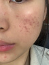 赫柏皙赫柏皙肌原肽修復(fù)套裝潔面水乳乳液面霜修護液美容院同款 微肽創(chuàng)舒舒護乳40g 曬單實拍圖