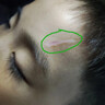 Hirudoid泰國喜遼妥疤痕膏 燙傷痘印凹疤增生修復(fù) 刀疤雙眼皮妊娠紋剖腹產(chǎn) 泰國原裝 40g 1盒 曬單實(shí)拍圖