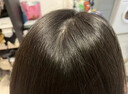 澳福來(lái)毛囊炎噴劑頭皮殺菌消炎噴霧頭皮脂溢性皮炎止癢抑菌長(cháng)疙瘩毛囊凈 特效毛囊凈頭皮上起疙瘩抑菌專(zhuān)用 曬單實(shí)拍圖