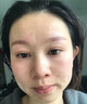 焦博士日本a醇精華液抗皺緊致精華抗衰老玻尿酸原液淡化細紋去黃女男士 【全臉抗皺】買1送1，買2發(fā)3僅需119 曬單實拍圖