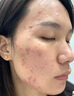 ZHENMI新加坡進(jìn)口377氨基酸洗面奶男女士控油祛痘去黑頭淡斑提亮膚色 曬單實拍圖