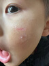 華美科醫(yī)用重組人體表皮生長因子點(diǎn)痣疤痕修復(fù)凝膠燙軟膏傷口愈合15g1支 曬單實(shí)拍圖