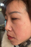 維a酸乳膏去老年斑專用藥一夜消祛斑點(diǎn)斑專用藥水去除老年斑特有效藥手臉部雀黃褐斑老人斑皮膚用藥 1盒裝【去老年斑男士專用藥除老年黑斑臉部手背】 曬單實(shí)拍圖
